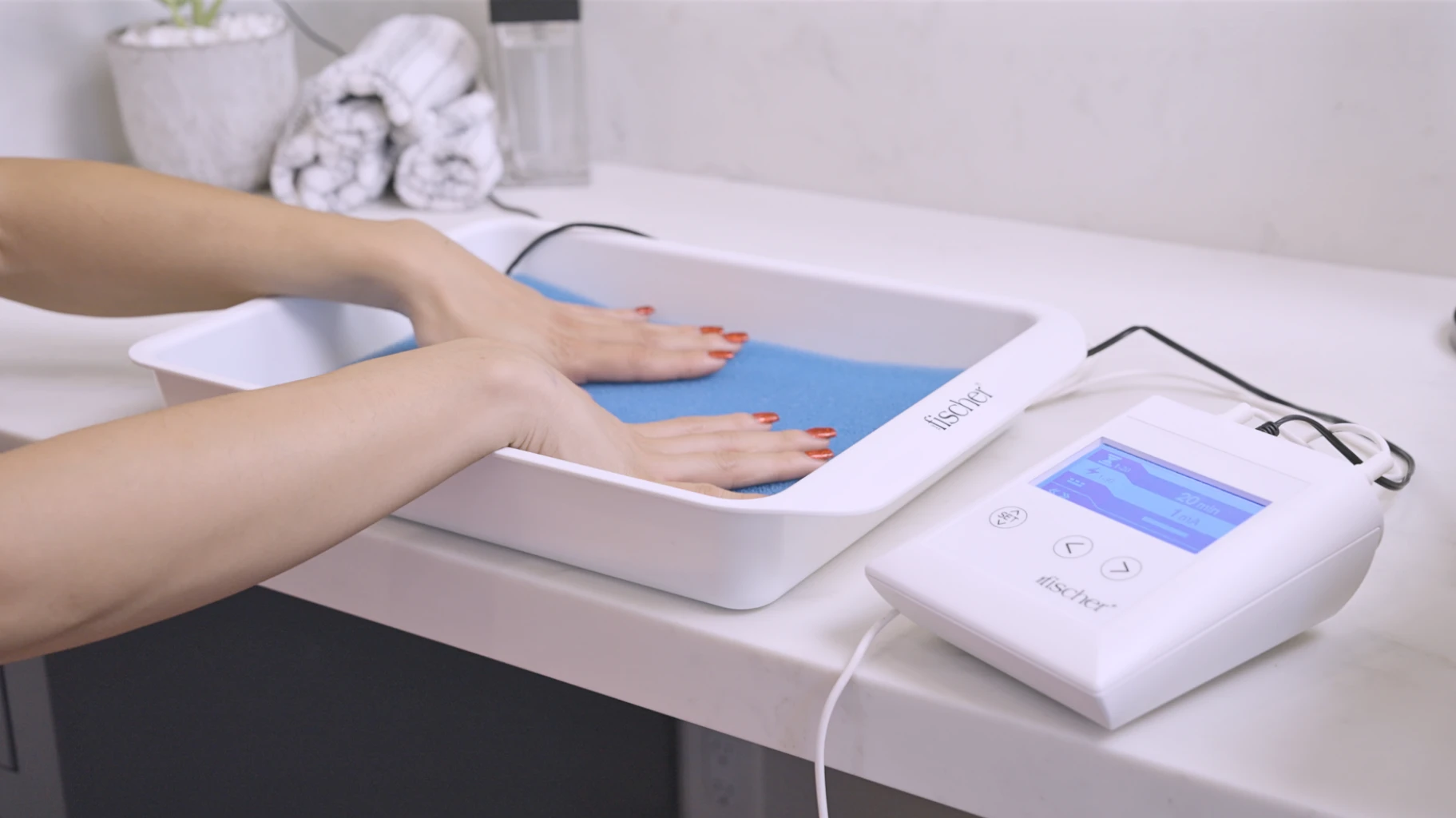 Image: In this photo, we focus solely on the arms and hands of an individual undergoing treatment for palmar hyperhidrosis, characterized by excessive sweating of the hands. They are utilizing RA Fischer Co.'s The Fischer iontophoresis device, placed on a white table. The setup includes white water bath trays, metal-free silicone electrodes with pH-balancing foam within the tray, all set against a clean white backdrop. The Fischer iontophoresis device, distinguished by its white rectangular shape, features a blue and grey screen, with buttons labeled "SET" and directional arrows. The logo of the Fischer device is discreetly positioned in the bottom right corner.