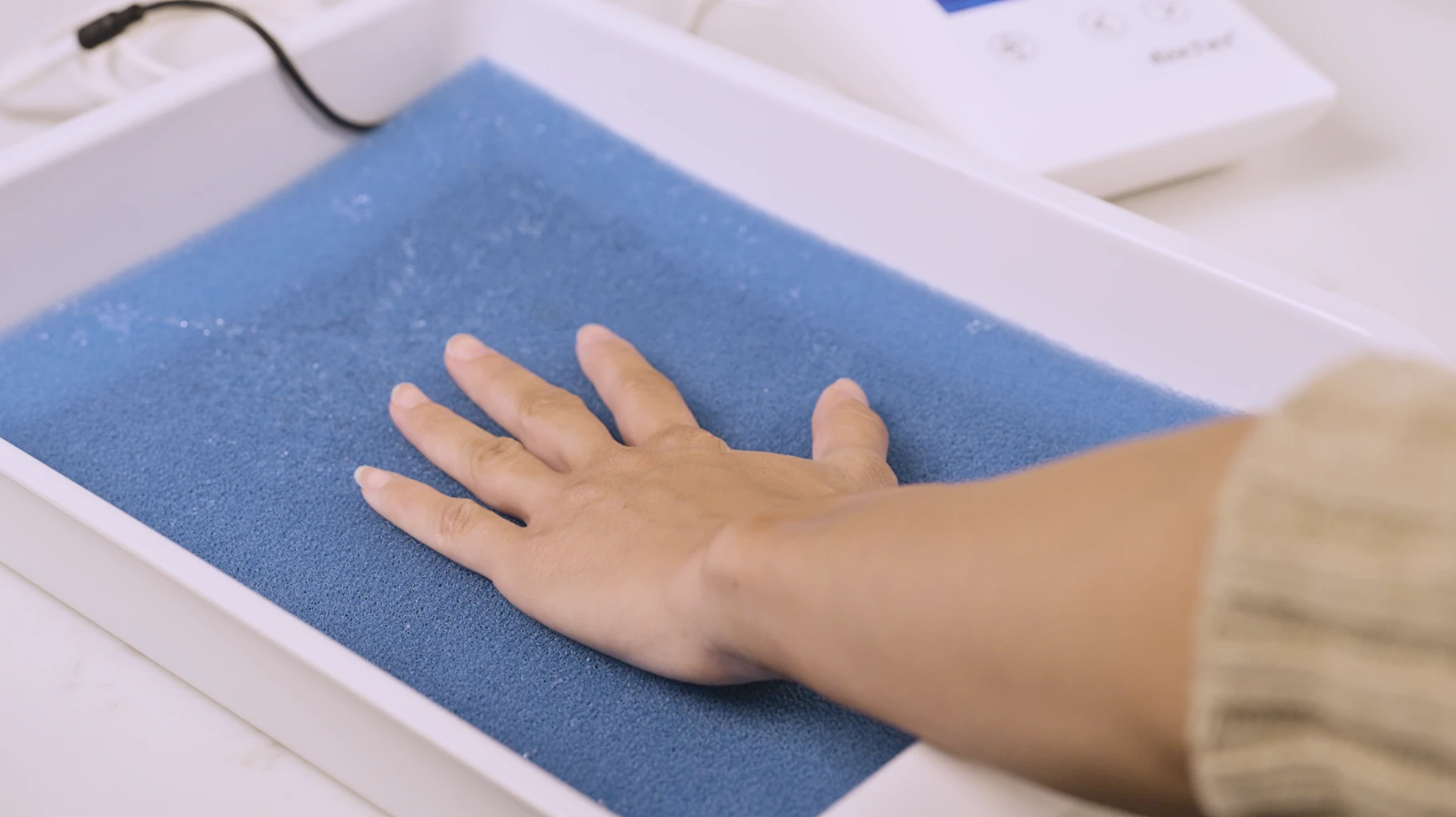 Image: An individual effectively managing palmar (hands) hyperhidrosis utilizes RA Fischer Co.'s original metal-free iontophoresis device, "The Fischer." Their hand is comfortably placed within one of the white water bath trays containing blue pH-balancing foam and equipped with silicone-graphite electrodes, demonstrating a comprehensive solution for treating their condition.