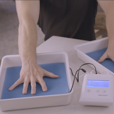 A man wearing a black shirt putting his hands into the Fischer iontophoresis device water bath trays to treat palmar hyperhidrosis aka excessive sweating of the hands