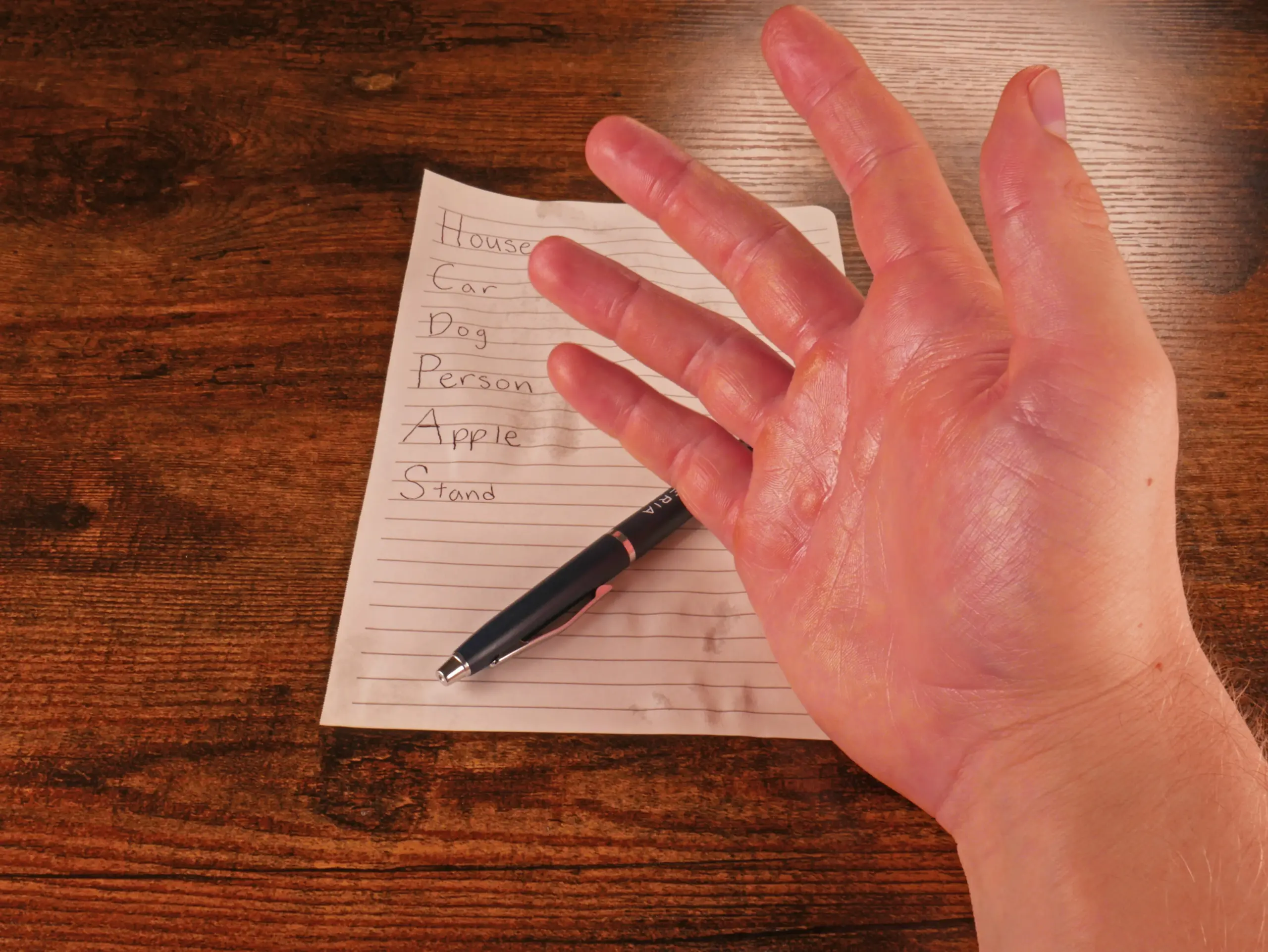 Close up image of a hand of a person who has hyperhidrosis. Hand covered in sweat. Behind hand is pen and piece of paper with sweat marks sitting on a wooden desk. [insurance coverage for medical supplies] [ RA fischer hyperhidrosis iontophoresis ]