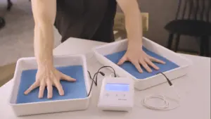 An overhead photograph of only the arms and hands of a person facing forward treating their palmar hyperhidrosis (excessive sweating of the hands) using RA Fischer Co.'s The Fischer iontophoresis device on a white table. White water bath trays and black, metal-free silicone electrodes with ph-balancing foam inside the tray on a plain white background. The Fischer iontophoresis device is white and rectangular with a blue and grey screen. Buttons read "SET" and arrows. Logo of the Fischer device bottom right corner