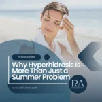 Why Hyperhidrosis Is More Than Just a Summer Problem